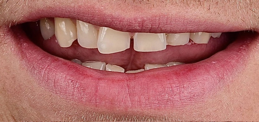 before-1.jpg before-1.jpg